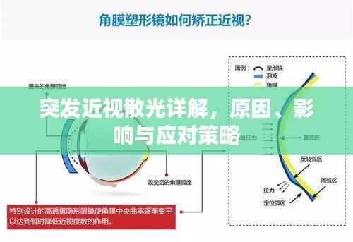 突发近视散光详解,原因、影响与应对策略