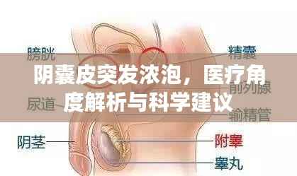 阴囊皮突发浓泡,医疗角度解析与科学建议
